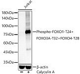 Western blot - Phospho-FOXO1-T24 + FOXO3A-T32 + FOXO4-T28 Rabbit mAb (AP1379)