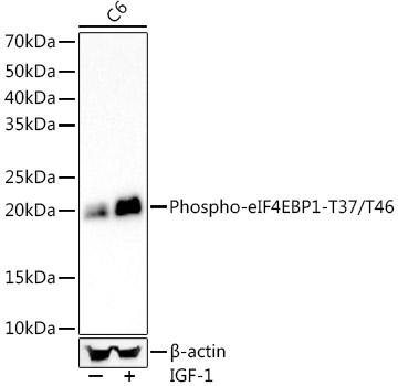 Phospho-eIF4EBP1-T37/T46 Rabbit mAb