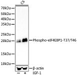 Western blot - Phospho-eIF4EBP1-T37/T46 Rabbit mAb (AP1381)