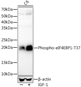 Phospho-eIF4EBP1-T37 Rabbit mAb