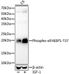 Western blot - Phospho-eIF4EBP1-T37 Rabbit mAb (AP1382)
