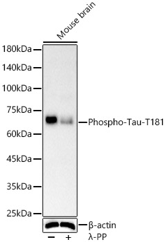 Phospho-Tau-T181 Rabbit mAb