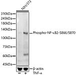 Western blot - Phospho-NF-κB2-S866/S870 Rabbit mAb (AP1391)