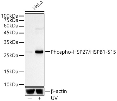 Phospho-HSP27/HSPB1-S15 Rabbit mAb