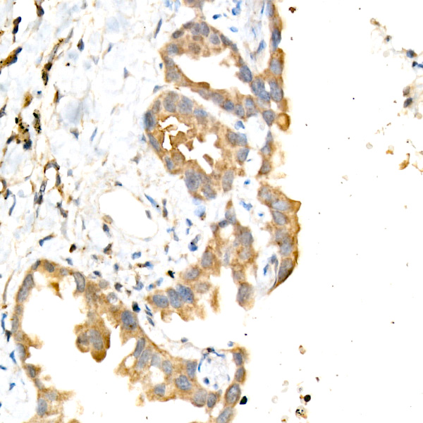 Phospho-mTOR-S2448 Rabbit monoclonal antibody