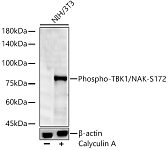 Western blot - Phospho-TBK1/NAK-S172 Rabbit mAb (AP1418)
