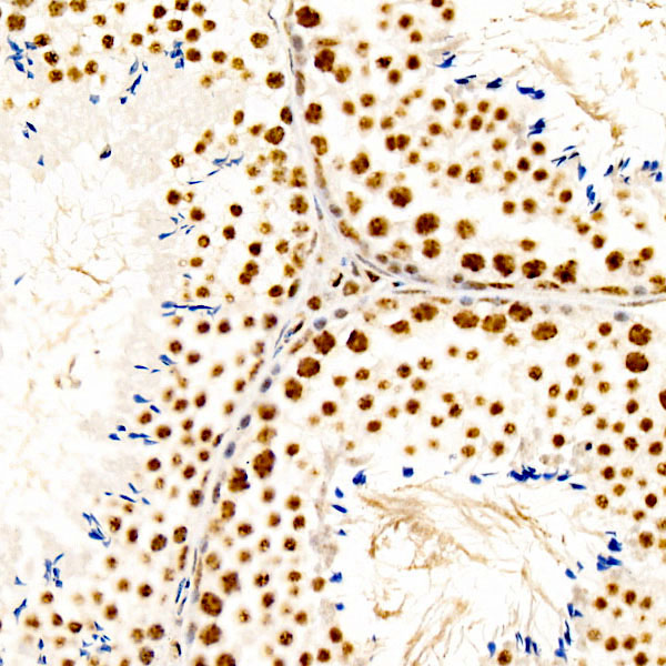 Phospho-CREB1-S133 Rabbit monoclonal antibody