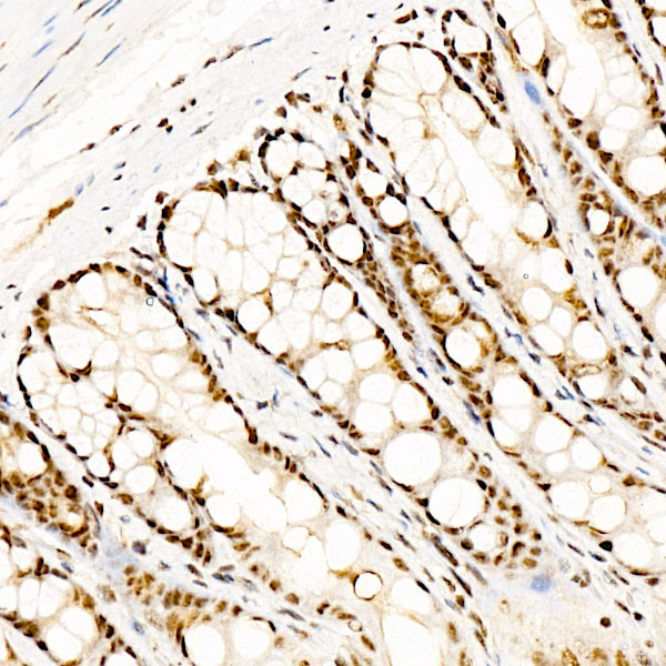 Phospho-CREB1-S133 Rabbit monoclonal antibody
