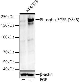 Phospho-EGFR (Y845) Rabbit mAb