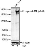 Western blot - Phospho-EGFR (Y845) Rabbit mAb (AP1425)