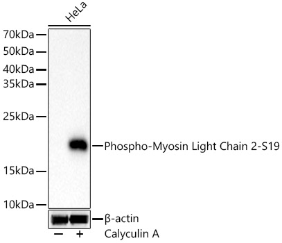Phospho-Myosin Light Chain 2-S19 Rabbit monoclonal antibody