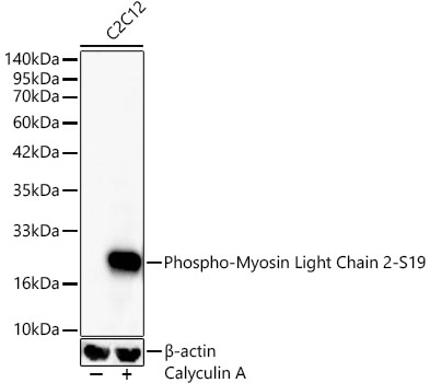 Phospho-Myosin Light Chain 2-S19 Rabbit monoclonal antibody
