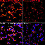 Immunofluorescence - Phospho-ZAP70-Y493 Rabbit mAb (AP1435)
