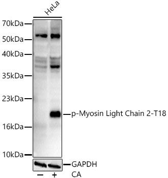 Phospho-Myosin Light Chain 2-T18 Rabbit mAb