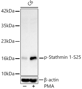 Phospho-Stathmin 1-S25 Rabbit mAb