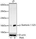 Western blot - Phospho-Stathmin 1-S25 Rabbit mAb (AP1440)
