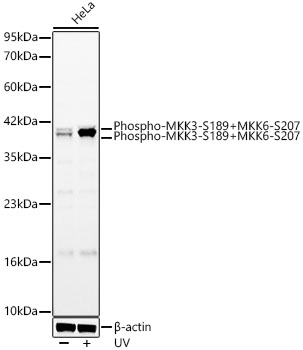 Phospho-MKK3-S189+MKK6-S207 Rabbit mAb