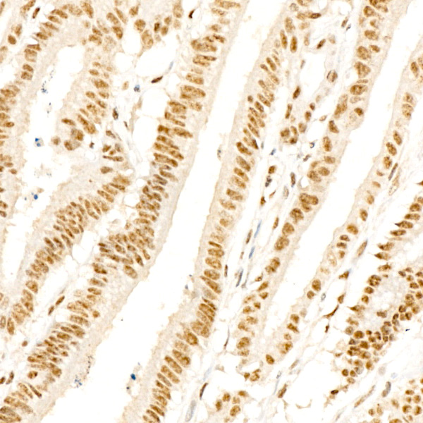Phospho-p38 MAPK-T180 Rabbit monoclonal antibody