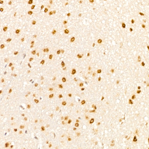 Phospho-p38 MAPK-T180 Rabbit monoclonal antibody