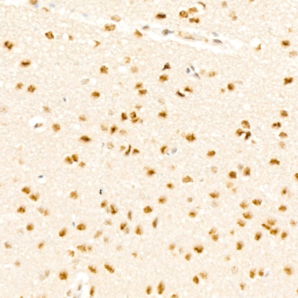 Phospho-p38 MAPK-T180 Rabbit monoclonal antibody