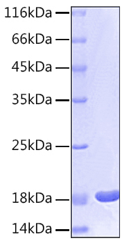 Recombinant Human IL-1 beta Protein
