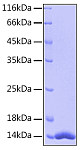 Recombinant Human FABP4/A-FABP/ALBP Protein (RP00008)
