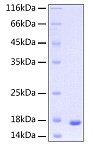 Recombinant Human UBE2D3 Protein (RP00012)