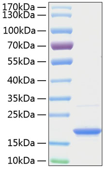Recombinant Human TNFSF13B/BAFF/CD257 Protein