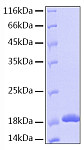Recombinant Human IL-36 beta/IL-1F8 Protein (RP00020)