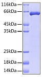 Recombinant Human ERK2/MAPK1 Protein (RP00026)