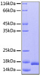 Recombinant Human IL-36Ra/IL-1F5 Protein (RP00030)