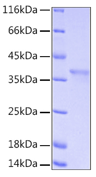 Recombinant Human IkB-alpha/NFKBIA Protein