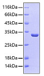 Recombinant Human Sulfotransferase 1A1/SULT1A1 Protein (RP00037)