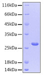 Recombinant Human CNTF Protein (RP00039)