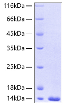 Recombinant Human FABP4/A-FABP/ALBP(A29T) Protein