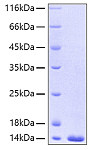 Recombinant Human FABP4/A-FABP/ALBP(A29T) Protein (RP00045)