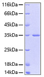 Recombinant Human FGFR-2/KGFR/CD332 Protein (RP00046)