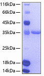 Recombinant Human TIE2/TEK/CD202b Protein (RP00048)