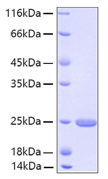Recombinant Human FGF-21 Protein
