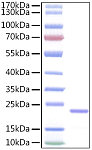 Recombinant Human IL-11 Protein (RP00050)