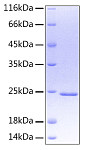 Recombinant Human Oncostatin-M/OSM Protein (RP00054)