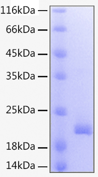 Recombinant Human TNFSF9/4-1BB Ligand Protein