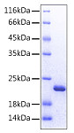 Recombinant Human FGF-12 Protein (RP00064)