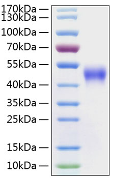 Recombinant Human Fc-gamma RIII alpha/CD16a  Protein