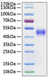 Recombinant Human Fc-gamma RIII alpha/CD16a  Protein (RP00066)