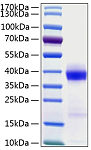 Recombinant Human B7-H1/PD-L1/CD274 Protein (RP00068)
