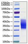 Recombinant Human TIM-3/HAVCR2/CD366 Protein (RP00069)