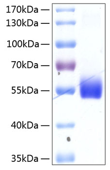 Recombinant Human TNFRSF14/HVEM/CD270 Protein