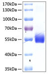 Recombinant Human TNFRSF14/HVEM/CD270 Protein (RP00070)