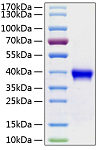 Active Recombinant Human R-spondin-1 Protein (RP00071)